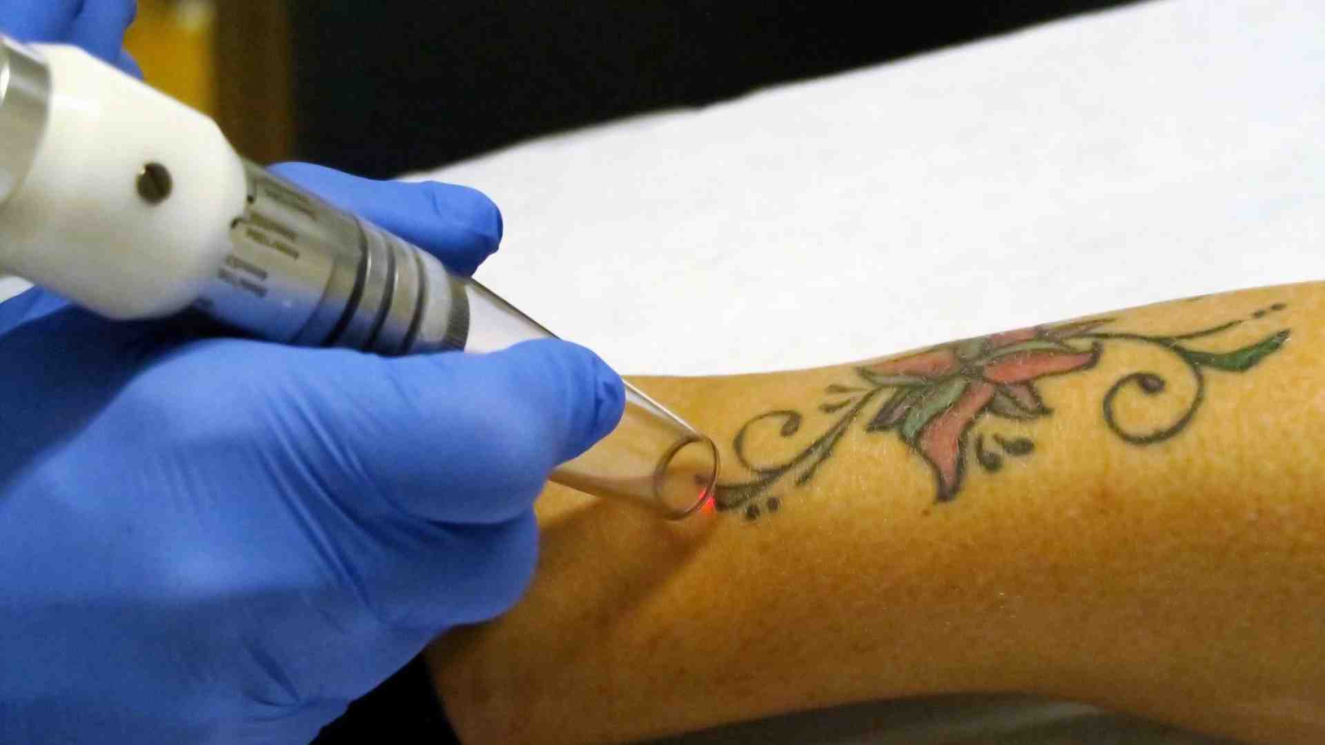 La mania dei tatuaggi è... irreversibile