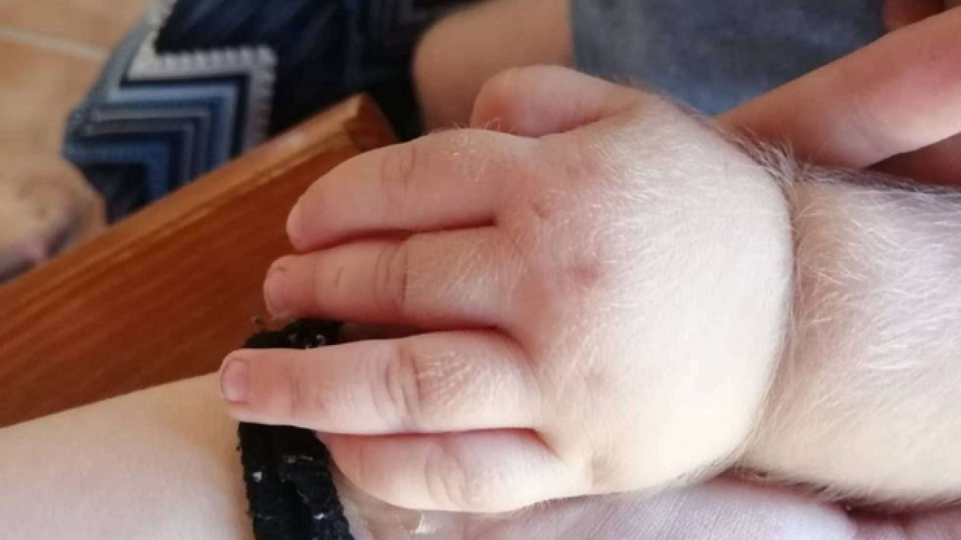 La sindrome del lupo colpisce 17 bimbi per un errore della casa farmaceutica