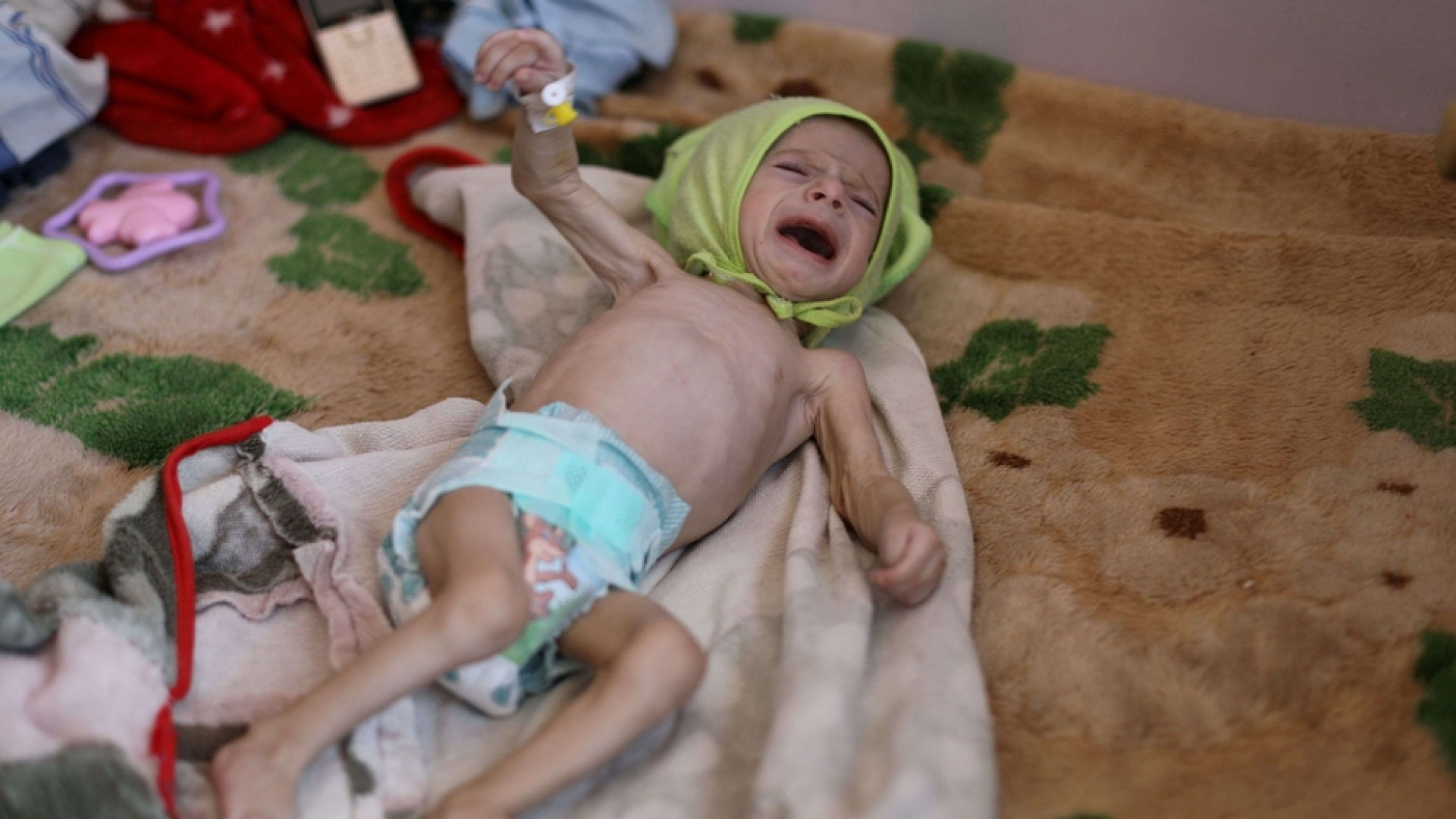 Yemen, rischio malnutrizione cronica per metà dei bambini sotto i 5 anni