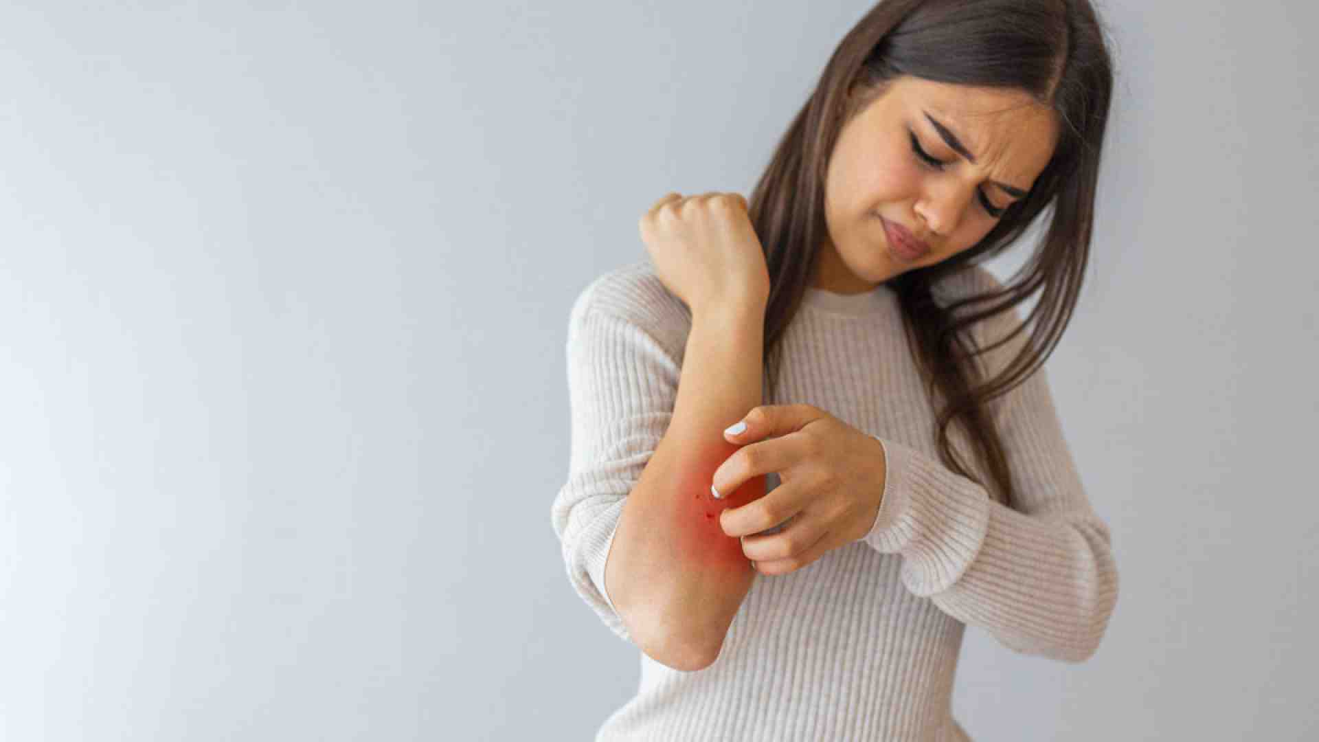 Maledetta psoriasi disturba più la mente che la pelle