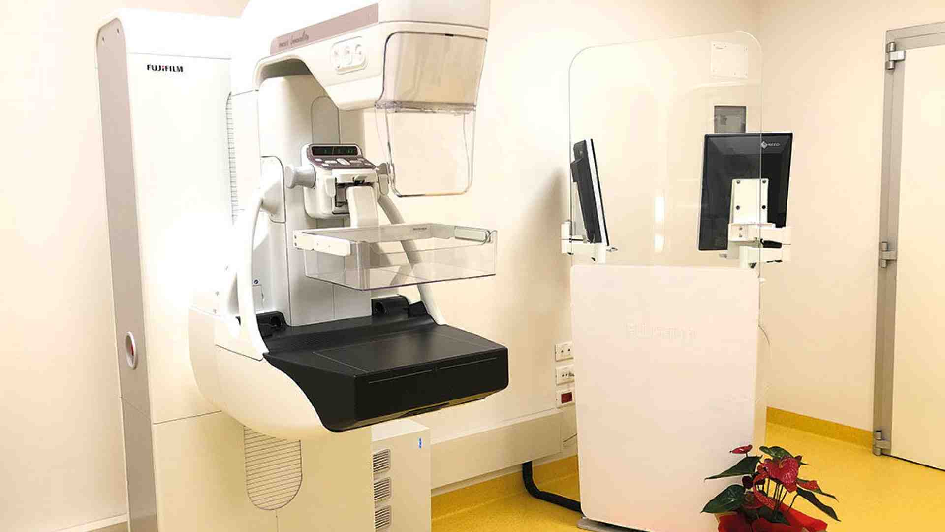 Bovolone. In arrivo un mammografo di nuova generazione