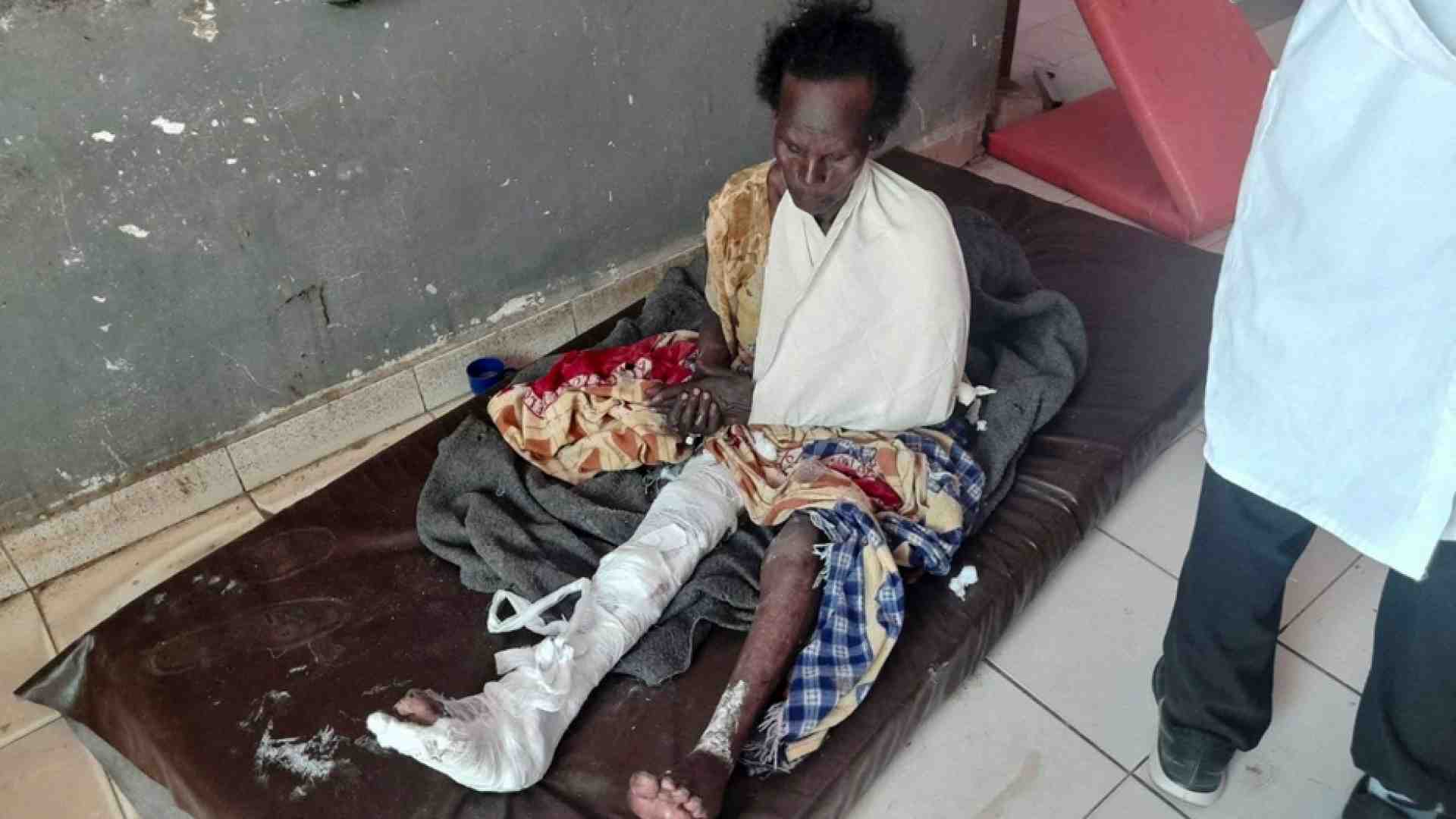 Reuters | Un sopravvissuto al bombardamento in ospedale a Dedebit