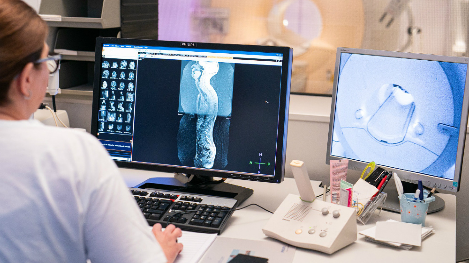 Radiologia: proseguono le prestazioni straordinarie, prenotazioni aperte per il mese di settembre