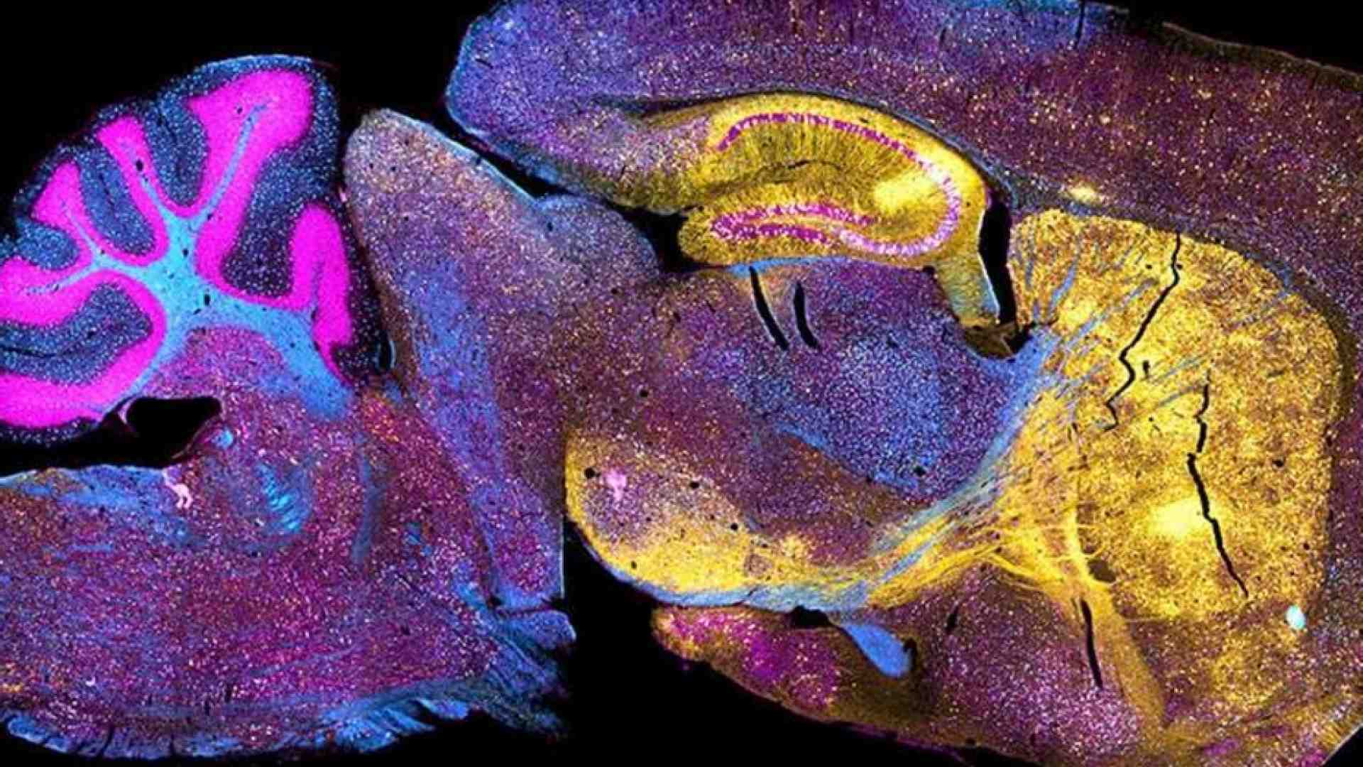 Chimere e organoidi che giocano: così si studia il cervello (con dubbi etici)