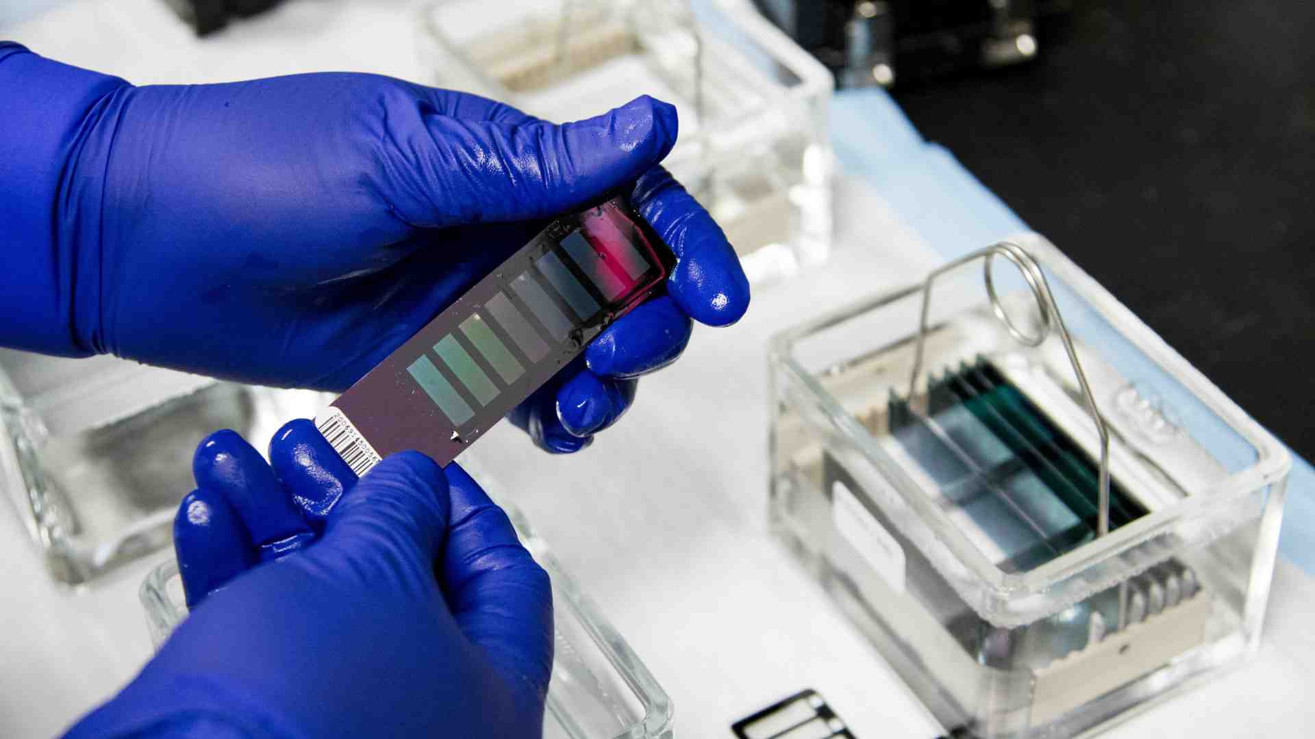 Dopo la carne coltivata, l'Europa apre alle tecniche genomiche per la modifica del Dna delle piante