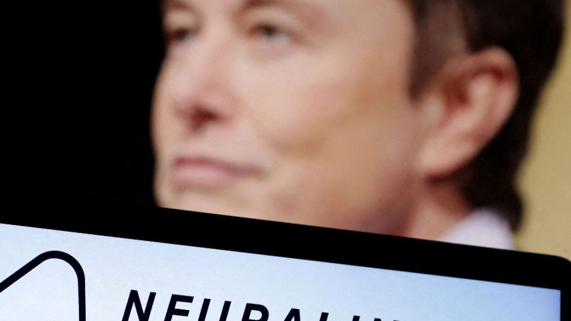 La sfida di Musk, fare “muovere” un tetraplegico con un chip nel cervello