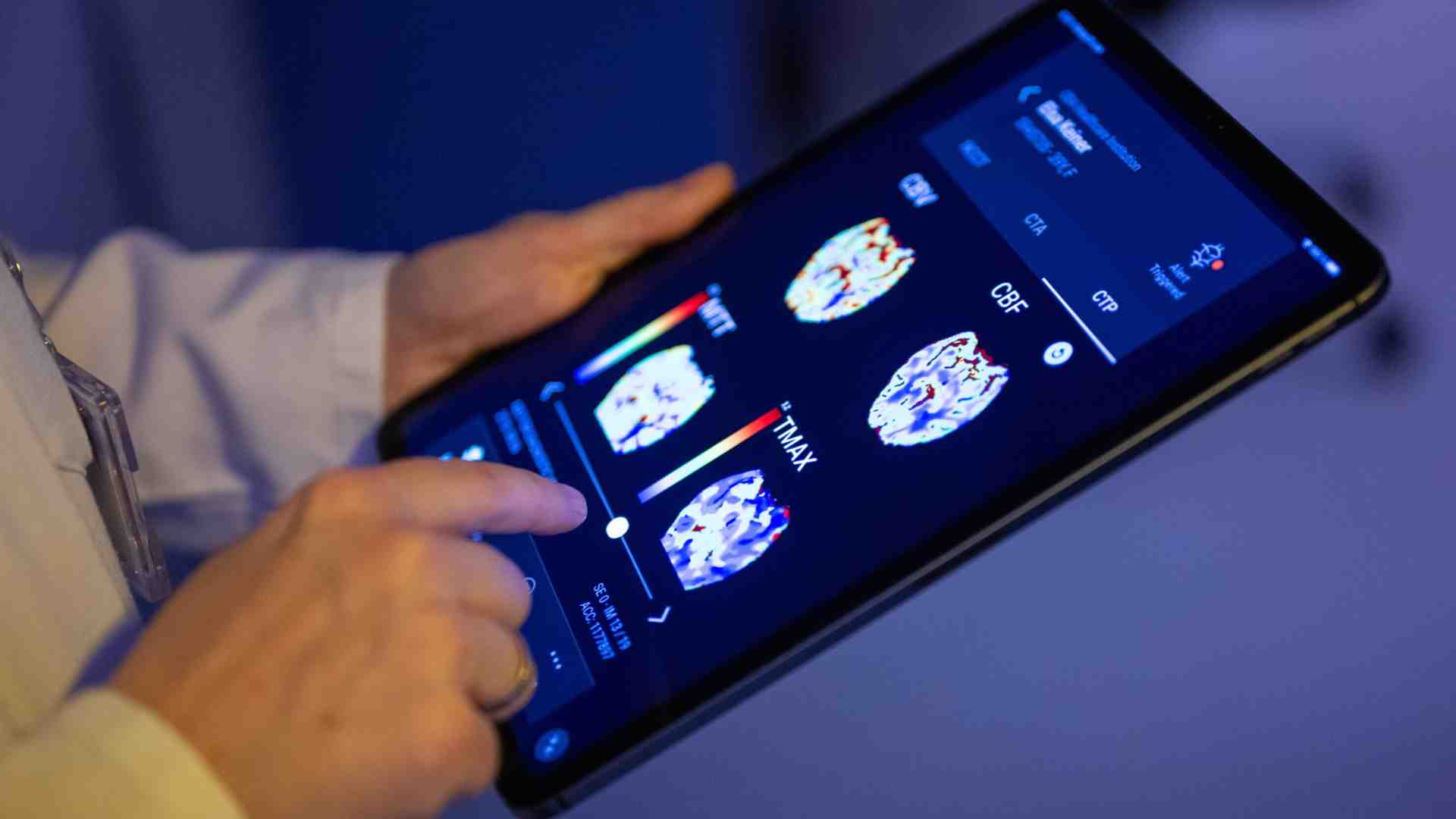 L’intelligenza artificiale può rivelare informazioni inedite sulla genetica e sul cuore