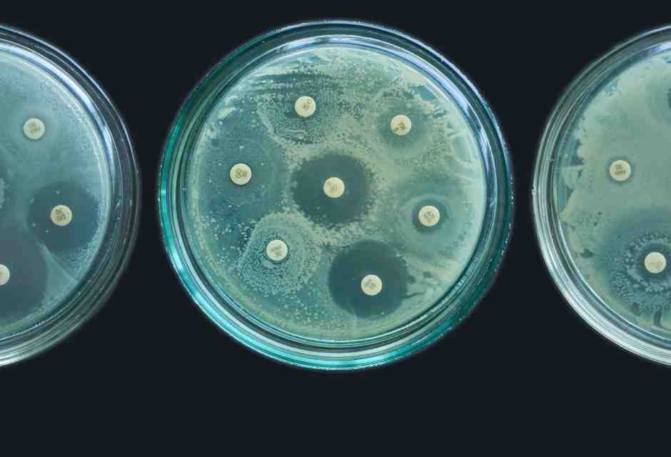 “Contro la farmaco resistenza serve una rivoluzione modello Hiv”. Parla Lucia Aleotti