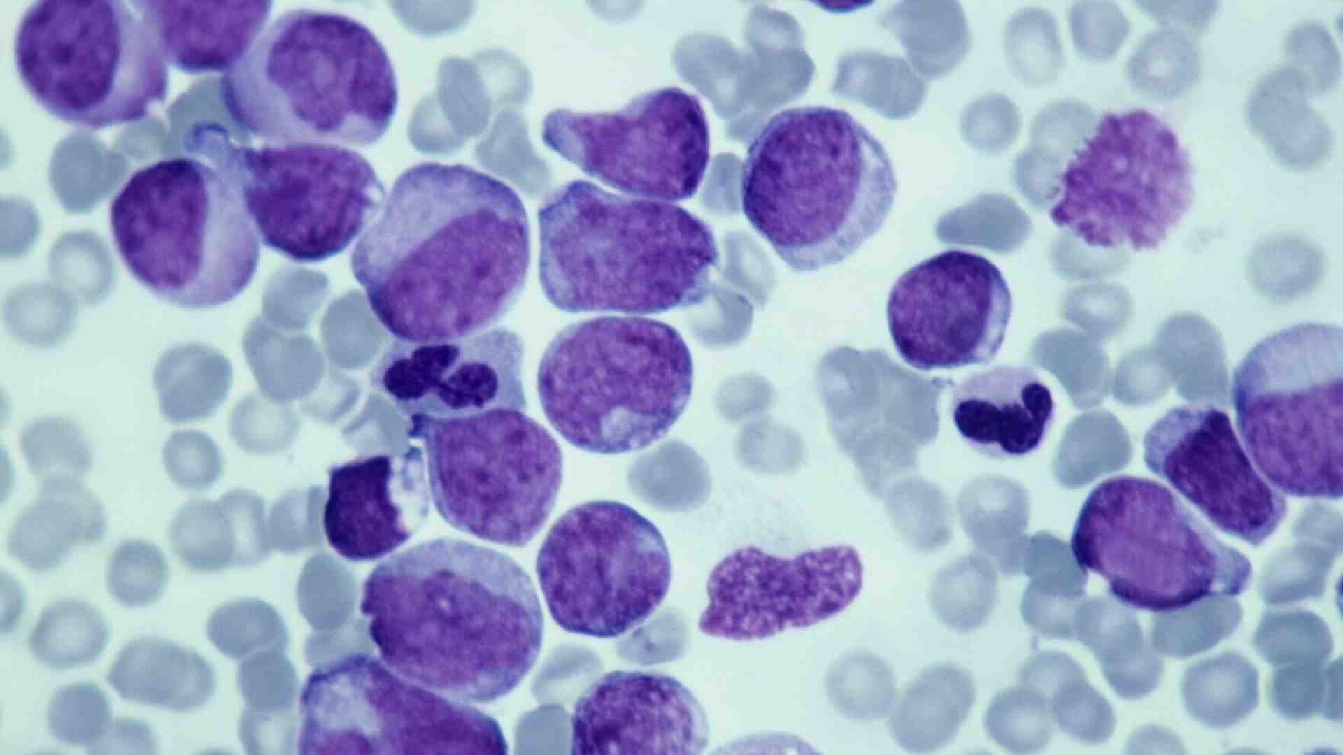 Cancro senza mutazioni: il ruolo nascosto delle modifiche epigenetiche