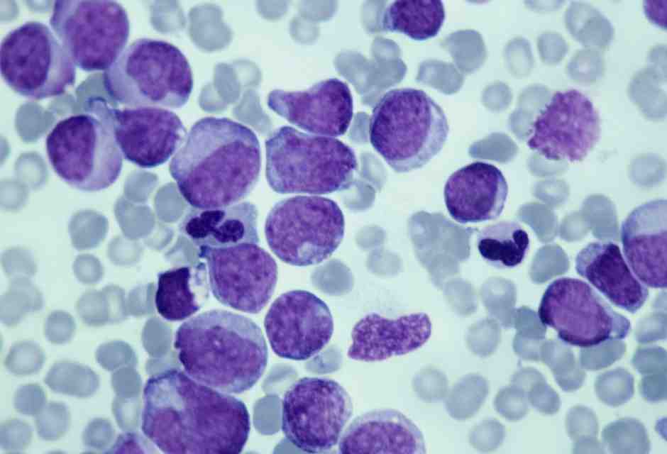 Cancro senza mutazioni: il ruolo nascosto delle modifiche epigenetiche