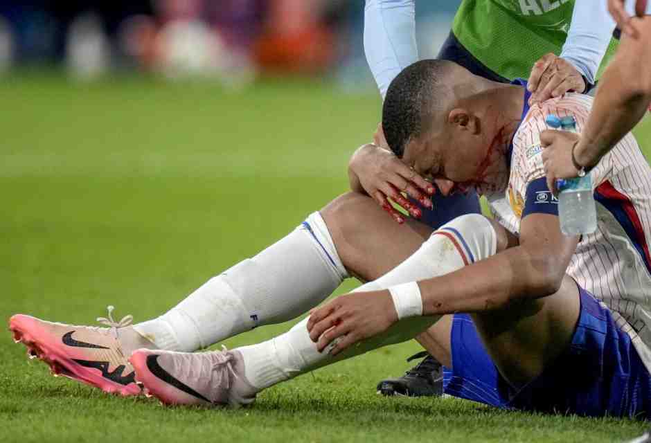 Il calcio è una questione di naso ma non ditelo a Mbappé