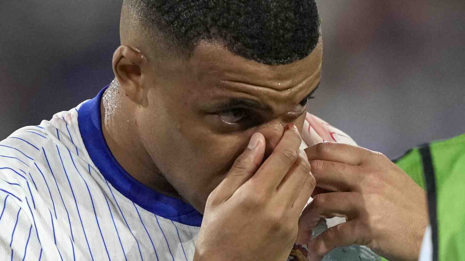 Quel naso allegro da francese in gita di Mbappé è il primo memorabilia di Euro 2024