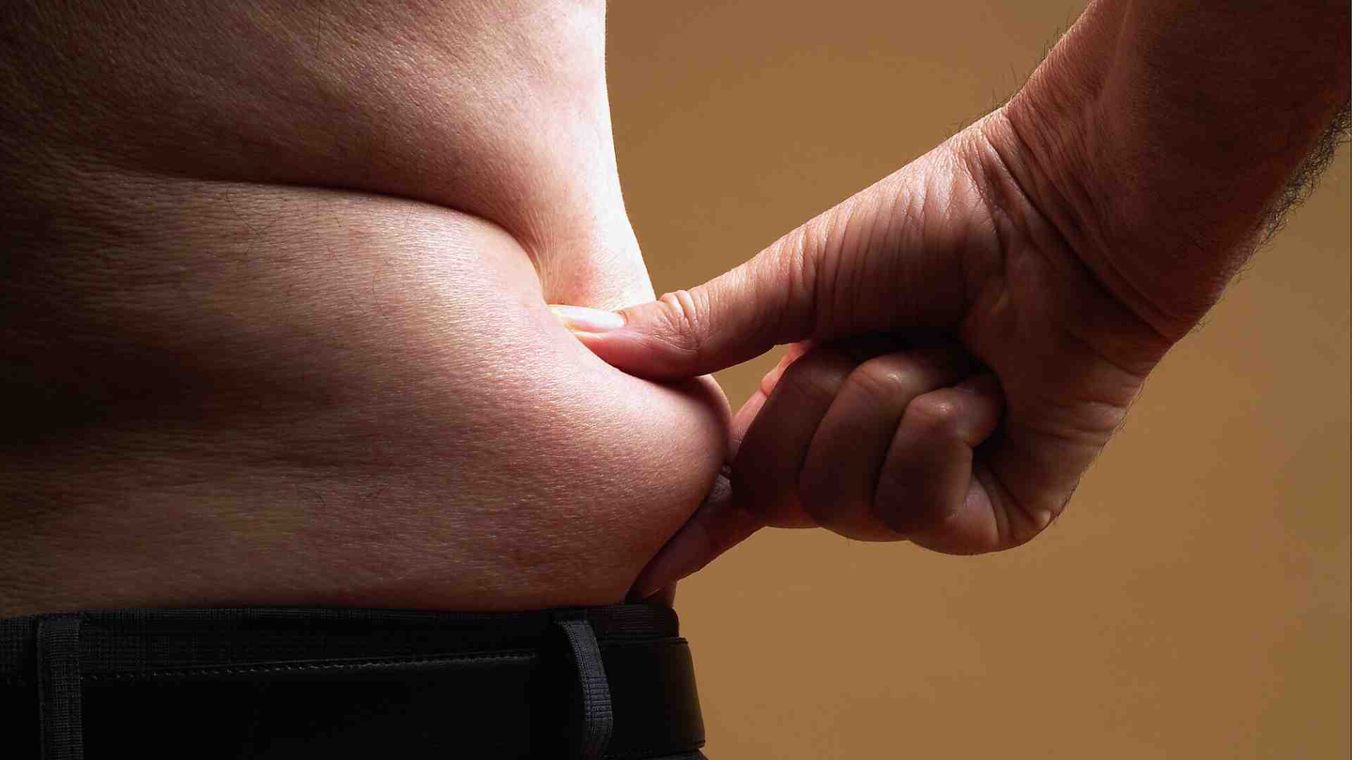 L'obesità a 17 anni ha una forte trasmissibilità familiare