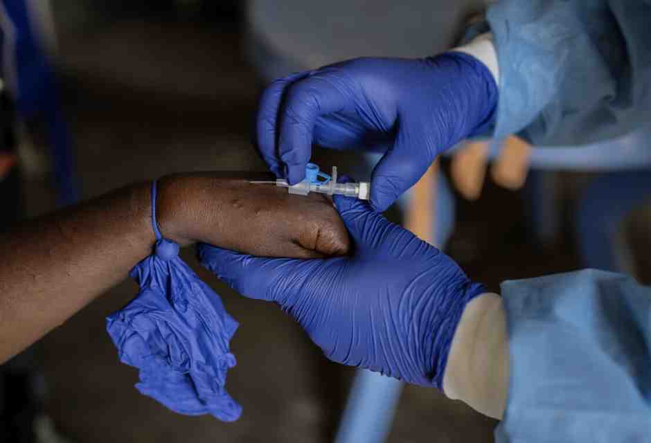 Il nuovo virus Mpox e la strada per far arrivare i vaccini dove servono