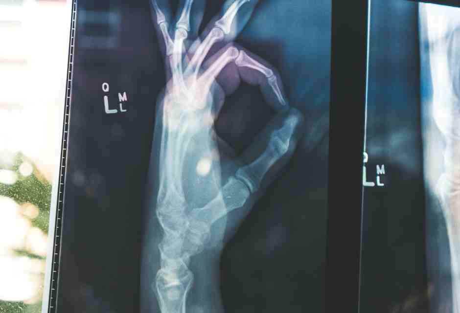 Bei tempi, quando ci slogavamo e andavamo dal "giustaossa"