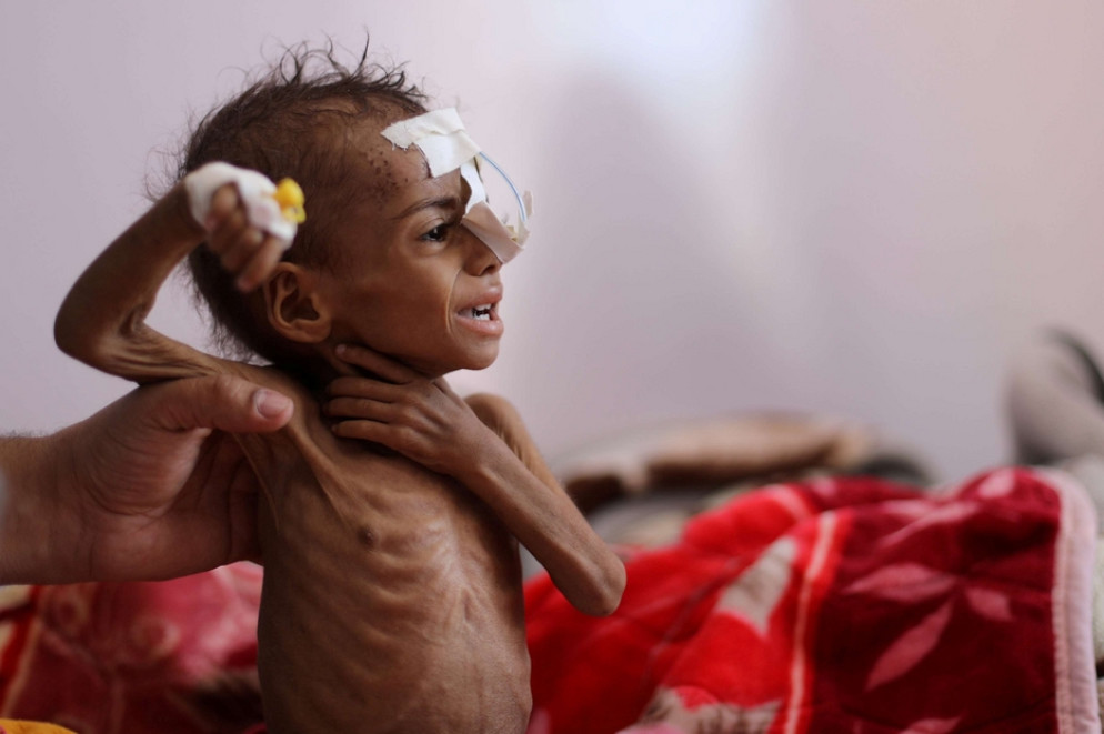 Un'infermiera assiste un bambino malnutrito all'ospedale al-Sabeen a Sanaa, Yemen (ottobre 2020) - REUTERS/Khaled Abdullah/File Photo