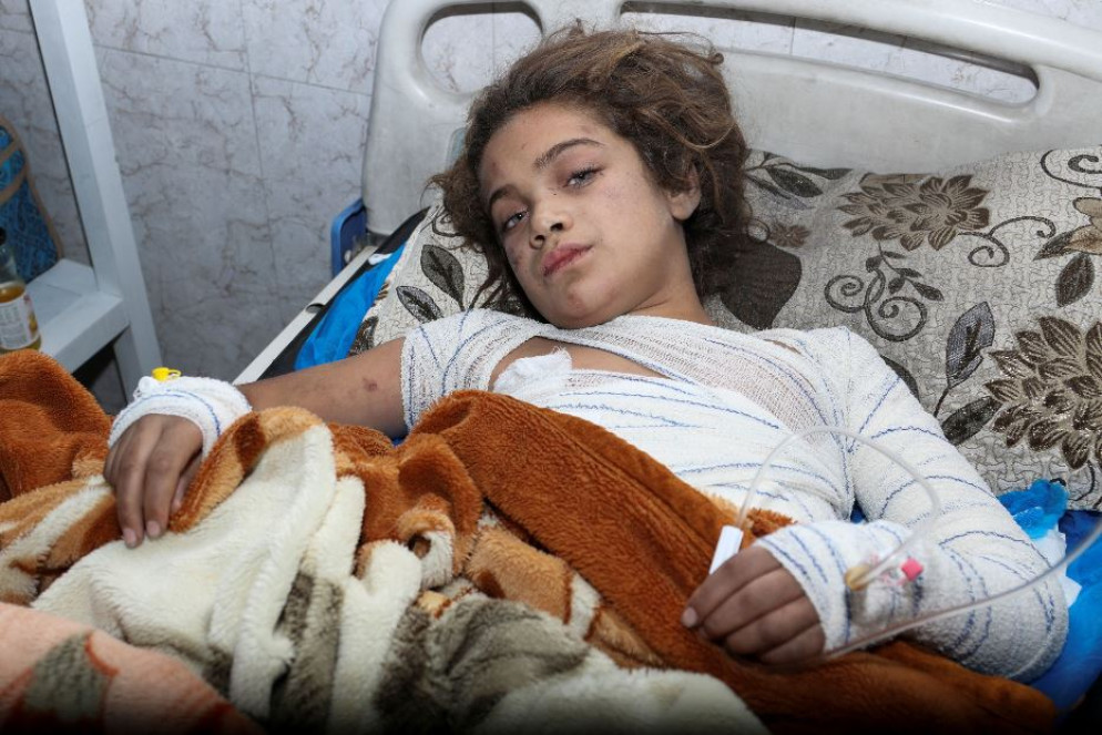 Una giovane invitata al matrimonio ricoverata in ospedale con ustioni - Reuters