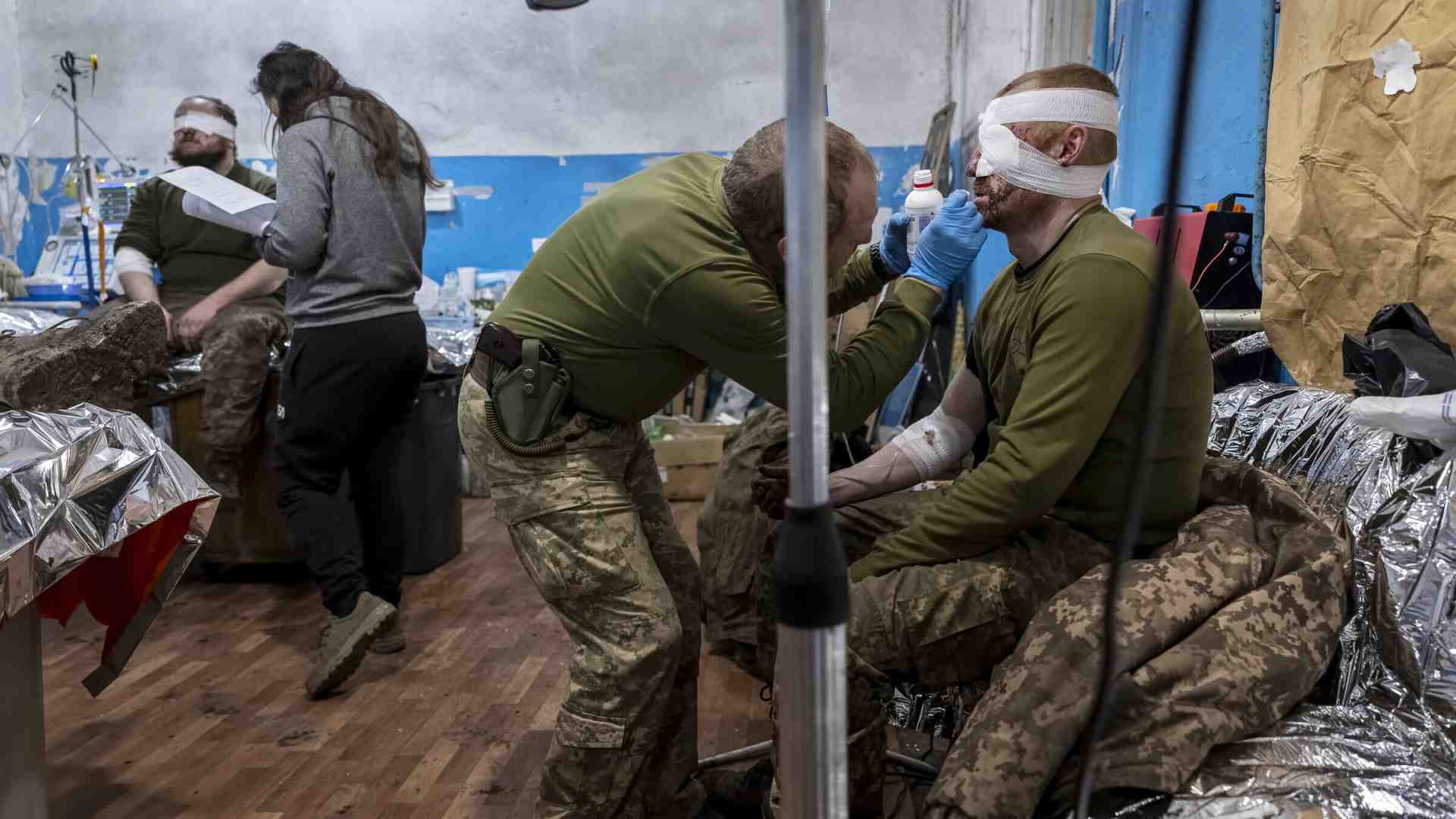 Come si cura il fronte