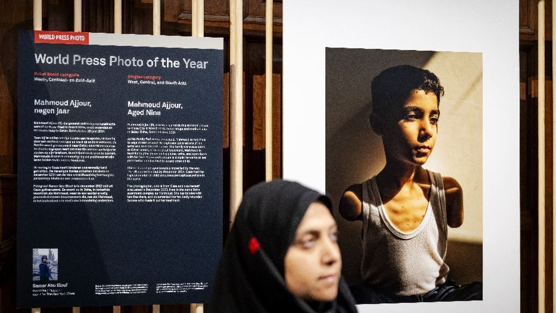 Vince il World Press Photo l'immagine di un bimbo amputato di Gaza